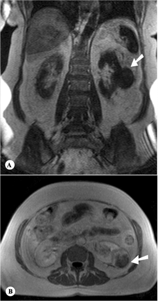 URODAY 3 GR 2 SASE 1 URODAY 3 GR 2 SASE 35414