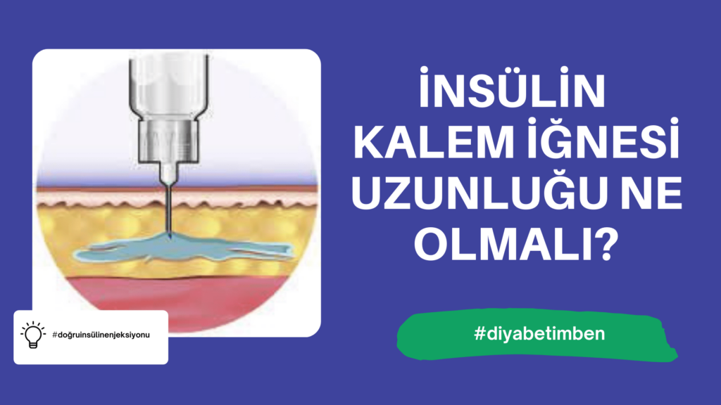WILLCARE INSULIN KALEM UCU İGNESİ 31G 8 MM 1 WILLCARE INSULIN KALEM UCU IGNESI 31G 8 MM 35785